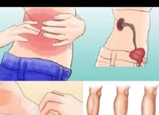 KAD SA BUBREZIMA NIJE SVE U REDU, TIJELO ŠALJE OVE SIGNALE: 6 SIMPTOMA KOJE NE SMIJETE IGNORISATI!