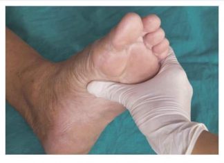 GANGRENA – UZROK I SIMPTOMI: EVO KADA SE MORATE JAVITI LJEKARU, 1 ZNAK NE SMIJETE IGNORISATI