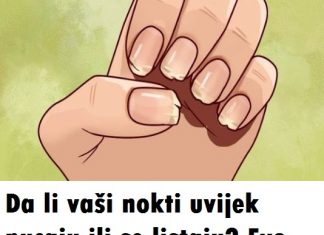 DA LI VAŠI NOKTI UVIJEK PUCAJU ILI SE LISTAJU? EVO ŠTA VAŠE TIJELO POKUŠAVA DA VAM KAŽE!
