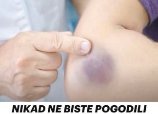 MODRICE JAVLJAJU PO TIJELU: NEMA VEZE SA POVREDAMA, PRAVI RAZLOG ĆE VAS ŠOKIRATI