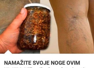 NAMAŽITE SVOJE NOGE OVIM ULJEM: Više nikada nećete imati problema sa proširenim VENAMA!