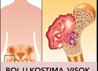 BOL U KOSTIMA, VISOK PRITISAK I TUGA: Simptomi da vam u tijelu nedostaje ovaj VAŽAN VITAMIN