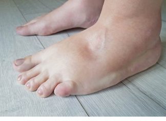 3 PUTA DNEVNO UZIMAJTE OVAJ PRIRODNI NAPITAK I NOGE VAM NEĆE OTICATI: Ubrzava metabolizam i izbacuje vodu iz organizma