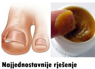 NAJJEDNOSTAVNIJE RJEŠENJE PROTIV GLJIVICA I URASLIH NOKTIJU, EVO KAKO IH UKLONITI
