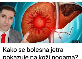 Kako se bolesna jetra pokazuje na koži,nogama? OVO SU SIMPTOMI BOLESNE JETRE…