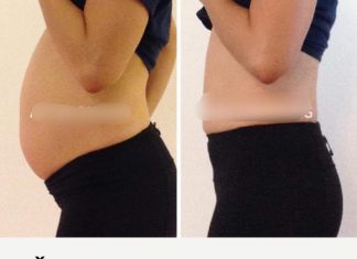 ŽELUDAC VAM NE VARI HRANU I STOMAK VAM JE NAPUHAN?: Odmah otiđite u kuhinju i OVO NAPRAVITE – preporodit ćete se!