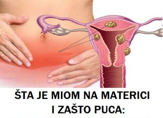 ŠTA JE MIOM NA MATERICI I ZAŠTO PUCA: Evo kad žena hitno mora da se javi ljekaru