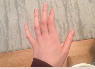 OBAVEZNO OBRATITE PAŽNJU: Ako vam trnu prsti, to može da znači nekoliko stvari, a ovo je uzrok