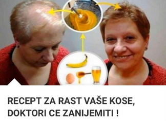 RECEPT ZA RAST VAŠE KOSE, DOKTORI CE ZANIJEMITI !