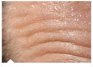 SAD JE JASNO! Evo Zašto Temperatura SKOČI NAVEČER KAD SMO BOLESNI, Čim Padne Mrak!