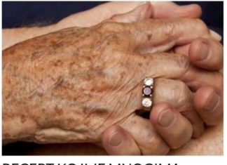 Brz i učinkovit tretman za staračke pjege: Isprobajte ovaj prirodni recept!