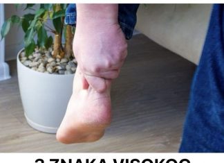 3 ZNAKA VISOKOG HOLESTEROLA: Odmah pogledajte vaše ruke i noge