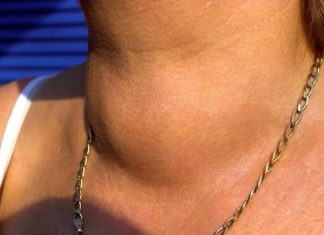 Neočekivani neprijatelji štitnjače: Evo koje namirnice izbjegavati i koje uključiti u prehranu