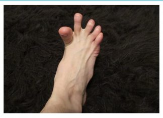 DA LI VAM SE GRČE PRSTI NA STOPALIMA? Evo Na Šta Vas To Upozorava, Može Biti Znak Većih Problema