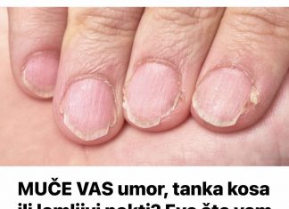 MUČE VAS umor, tanka kosa ili lomljivi nokti? Evo što vam NEDOSTAJE U ISHRANI