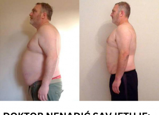 DOKTOR NENADIĆ SAVJETUJE: Evo kako da smršate pomoću jabukovog sirćeta – OVA KOMBINACIJA ČUDA ČINI