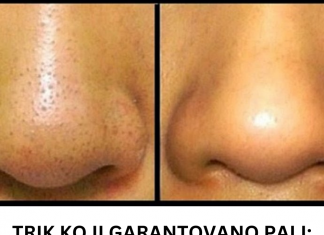 Trik koji garantovano radi: Riješite se mitesera s cijelog lica za deset minuta