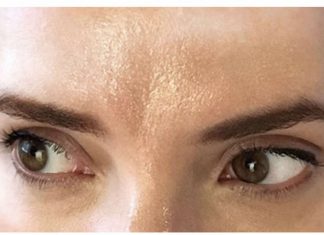 MASNO ČELO, BUBULJICE, GRUBI OBRAZI: Šta nam to koža PORUČUJE? OBAVEZNO POGLEDAJTE