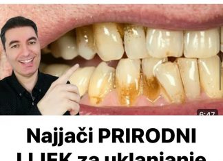 Najjači PRIRODNI LIJEK za uklanjanje ZUBNOG KAMENCA