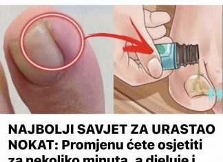 NAJBOLJI SAVJET ZA URASTAO NOKAT: Promjenu ćete osjetiti za nekoliko minuta, a djeluje i protiv modrica i gljivica!