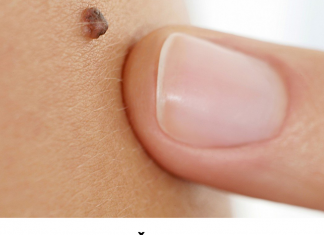 Iz mladeža vam rastu dlačice? Evo što to znači i kada biti na oprezu