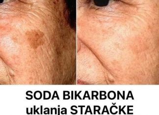 SODA BIKARBONA uklanja STARAČKE MRLJE! Ovo morate napraviti…