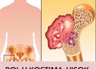 Ako osjetite bolove u kostima, visoki krvni tlak i osjećaj tuge, to može ukazivati na nedostatak ovog ključnog vitamina