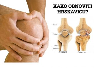 Artroza kolena simptomi i lečenje