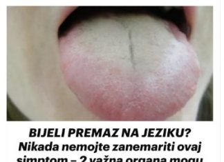 BIJELI PREMAZ NA JEZIKU? Nikada nemojte zanemariti ovaj simptom – 2 važna organa mogu biti oslabljena…