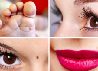 DA LI STE ZNALI? Položaj mladeža na telu otkiva vašu subinu – Na jednom mestu znači da ćete se obogatiti, a ako je na nosu i prstima, ne valja nikako