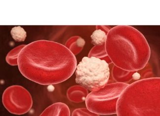 13 znakova povišenog šećera u krvi: Ako osetite simptome, ove namirnice odmah treba izbaciti iz ishrane