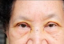 Urme – prirodna podrška zdravlju srca i creva