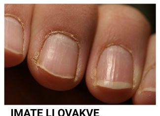 Promene na noktima ruku