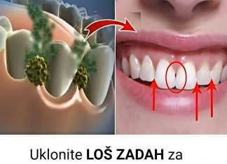 Isprobajte prirodni lek koji uništava bakterije u ustima i neprijatan zadah