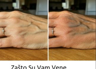 Zašto Su Vam Vene Odjednom Vidljivije? Uzroci, Savjeti i Kada Potražiti Pomoć