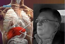 Ovo su najčešće bolesti jetre: Najčešće se otkriju kasno, a najteža pokosila Halida Bešlića…