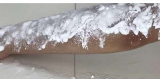 Prestanite da se brijete: Ova žena vam pokazuje TRIK kako da se riješite neželjenih dlačica na tijelu i bikiniju!