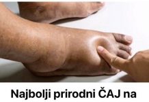 Recept za Najbolji Prirodni ČAJ Na Svijetu Za Uklanjanje 0TEKLINA!