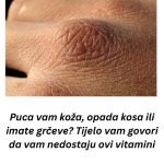 Puca vam koža, opada kosa ili imate grčeve? Tijelo vam govori da vam nedostaju ovi vitamini