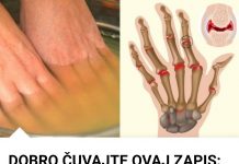 Bolovi u zglobovima ruku i nogu simptomi i lečenje