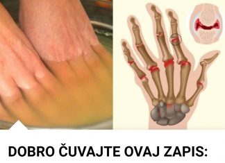 Bolovi u zglobovima ruku i nogu simptomi i lečenje