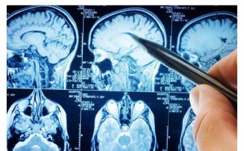 POVRĆE JE TOLIKO ZDRAVO DA O NJEMU PIŠE NJUJORK TAJMS: Amerikanci daju po 30 dolara za jedan list, a ono raste kod nas