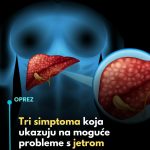 Ovo su 3 simptoma koja ukazuju na moguće probleme s jetrom