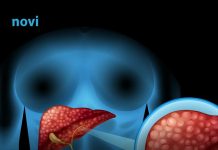Ovo su 3 simptoma koja ukazuju na moguće probleme s jetrom