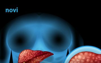 Ovo su 3 simptoma koja ukazuju na moguće probleme s jetrom