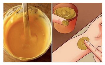 SPAS ZA BOLNA KOLJENA: Pomaže već poslije prvog nanošenja kod bolnih zglobova!