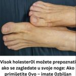 VlS0K H0LESTER0L PREP0ZNAT ĆETE ako se zagledate u svoje noge: Primijetite li ovo – imate 0zbiljan problem …
