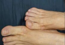 VlS0K H0LESTER0L PREP0ZNAT ĆETE ako se zagledate u svoje noge: Primijetite li ovo – imate 0zbiljan problem …