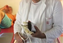 0Vl SlMPT0Ml UKAZUJU NA ZGRUŠENU KRV U TIJELU: Slijedi VAM SRČANI I M0ŽDANI UDAR- U VELIKOJ ste OPASNOSTI …