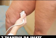 7 JASNlH ZNAK0VA DA IMATE NED0STATAK VlTAMINA “D”